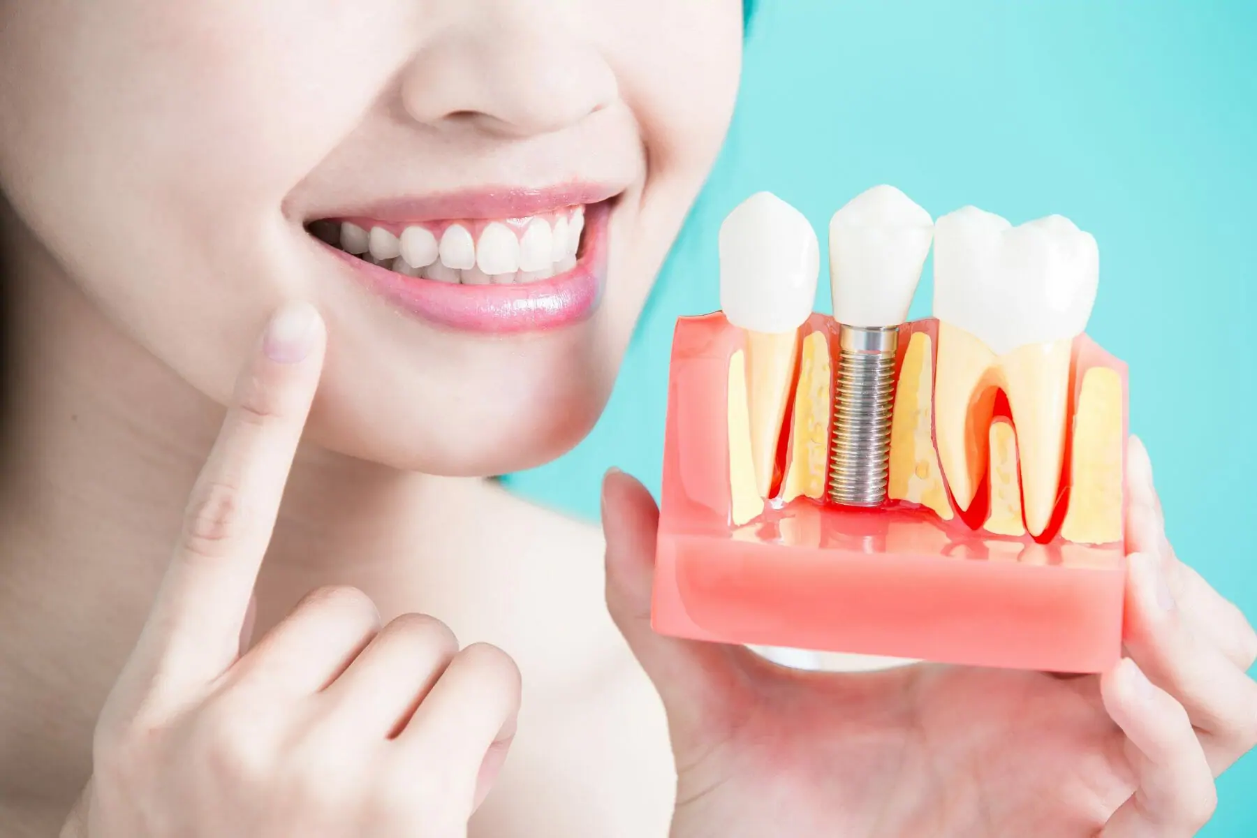 Aurora Borealis Dentistry – Expert in Restorative Crowns